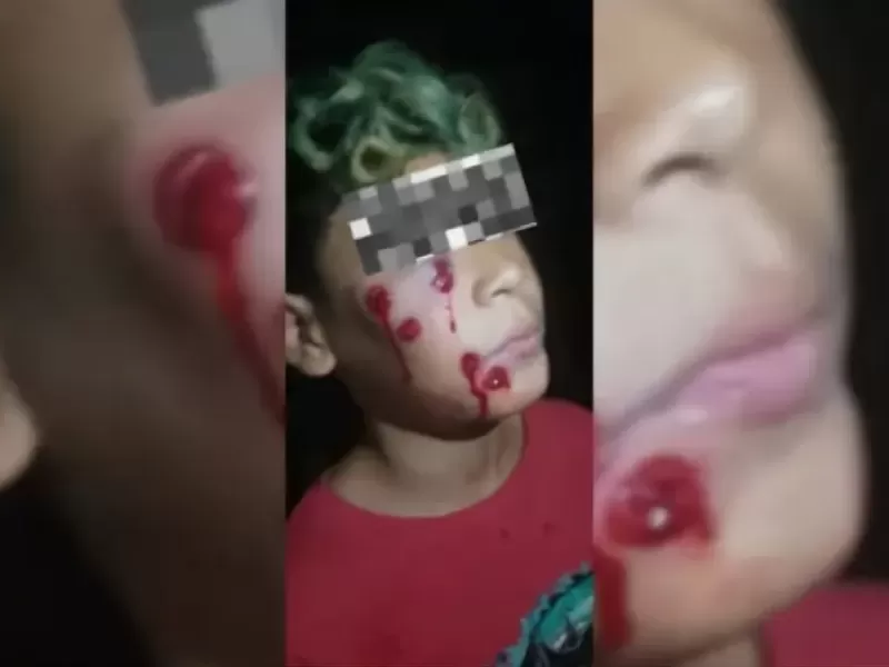 Quilmes: niño herido por disparo de escopeta con postas de goma en operativo policial