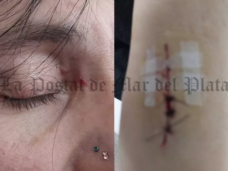 Tigre en alerta por caso de agresión a militante que apunta a la gestión municipal