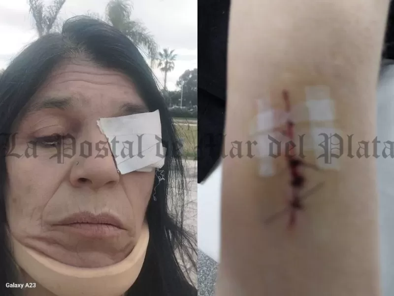 Tigre en alerta por caso de agresión a militante que apunta a la gestión municipal