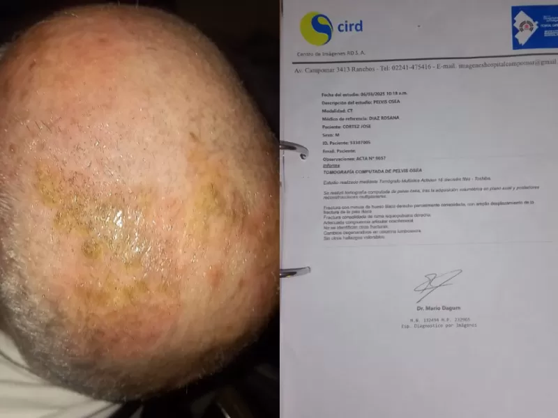 General Paz: familiares de víctimas apuntan al Hospital Campomar