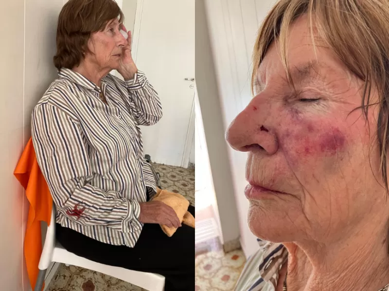 Cruel asalto en Mar del Plata dejó a una mujer de 82 años con varios dientes menos tras ser golpeada en el rostro