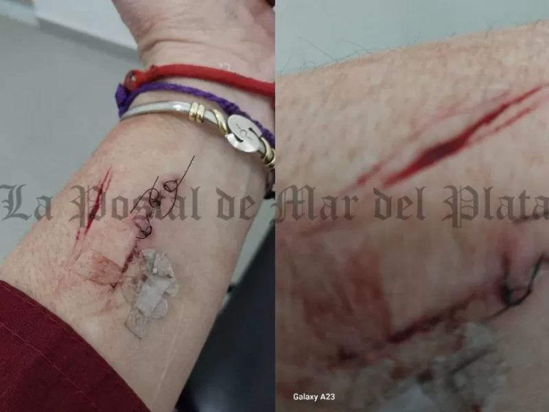 Tigre en alerta por caso de agresión a militante que apunta a la gestión municipal