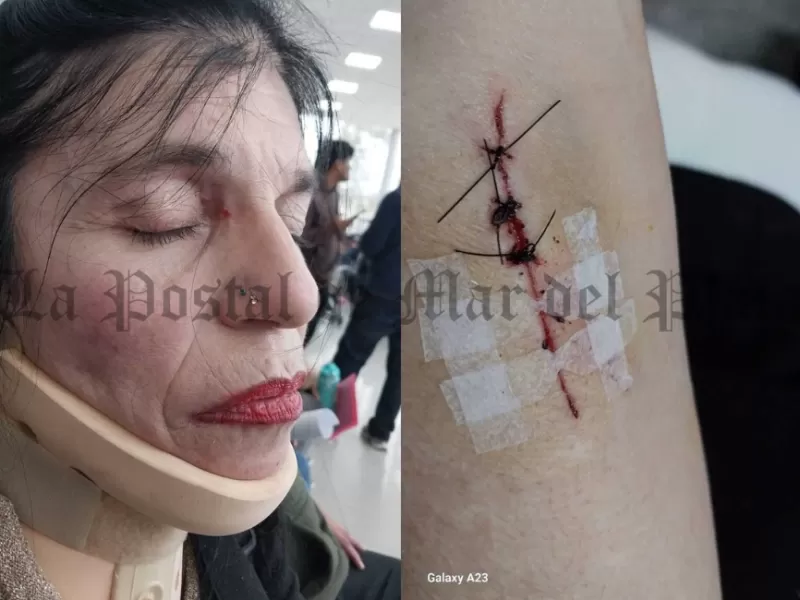 Tigre en alerta por caso de agresión a militante que apunta a la gestión municipal