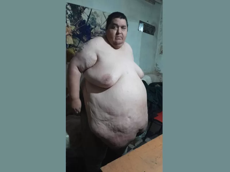 ¡Llegó a los 280 kilos y ahora necesita ayuda!