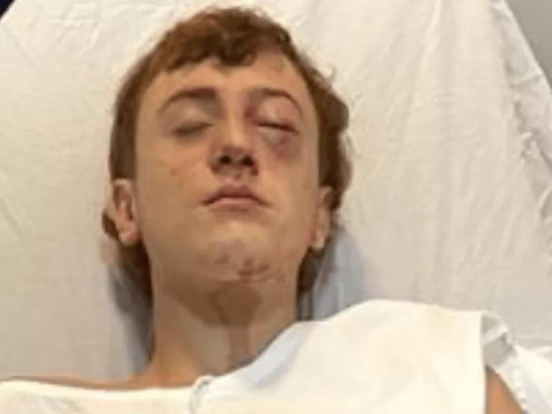 El hijo de un funcionario municipal de Montenegro golpeó brutalmente a un joven