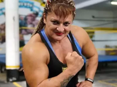 La última operación estética de “Locomotora” Oliveras quedó fuera del relato oficial