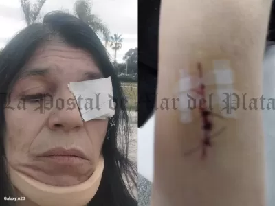 Tigre en alerta por caso de agresión a militante que apunta a la gestión municipal